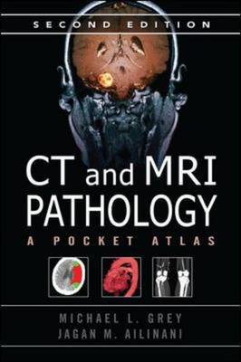 CT & MRI Pathology: a Pocket Atlas - ISE Edition 2nd Revised edition