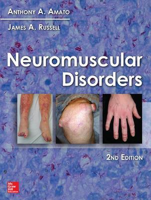 Neuromuscular Disorders 2nd edition