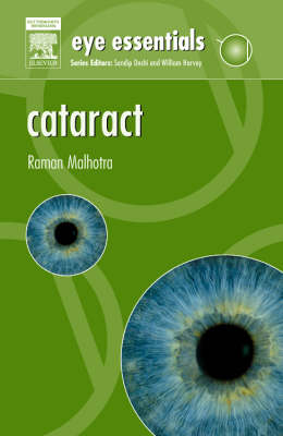 Cataract: Assessment, Classification and Management