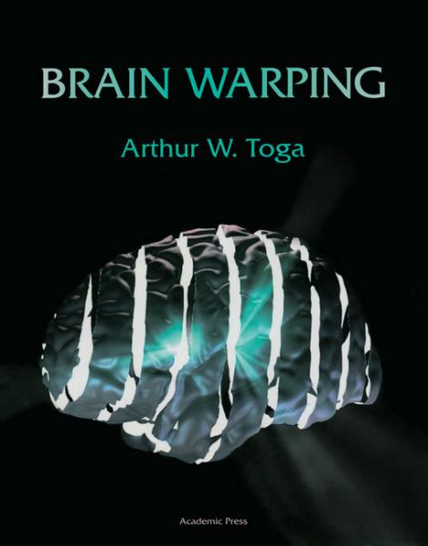 Brain Warping