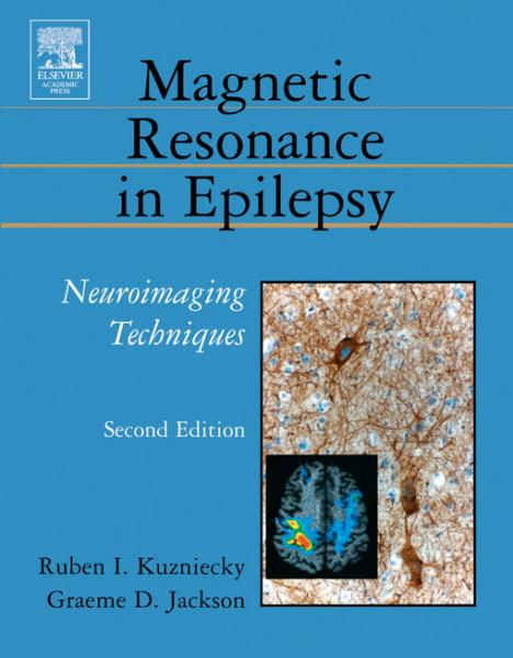 Brain Plasticity and Epilepsy: A Tribute to Frank Morrell