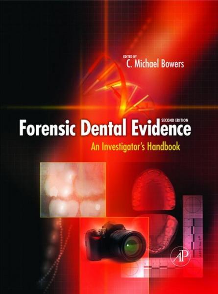 Forensic Dental Evidence: An Investigator's Handbook