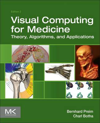 Visual Computing for Medicine: Theory, Algorithms, and Applications 2nd edition