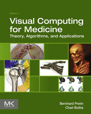 Visual Computing for Medicine: Theory, Algorithms, and Applications