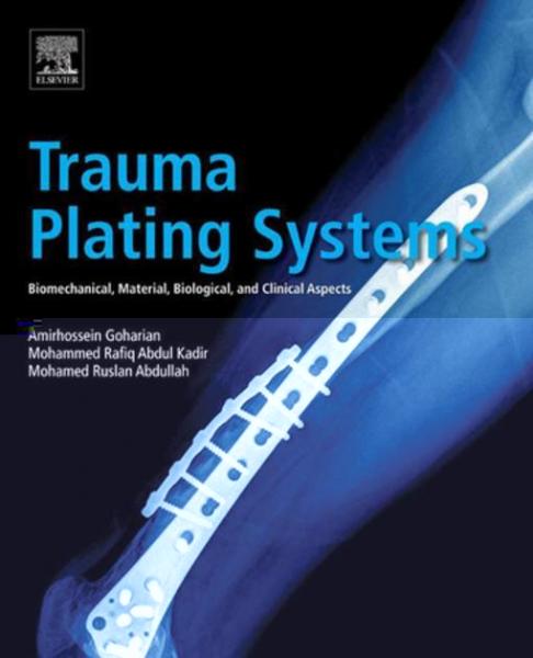 Trauma Plating Systems: Biomechanical, Material, Biological, and Clinical Aspects