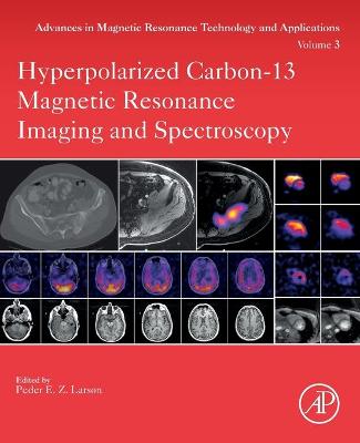 Hyperpolarized Carbon-13 Magnetic Resonance Imaging and Spectroscopy, Volume 3