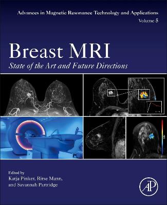 Breast MRI: State of the Art and Future Directions, Volume 5