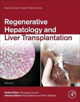 Regenerative Hepatology and Liver Transplantation, Volume 2