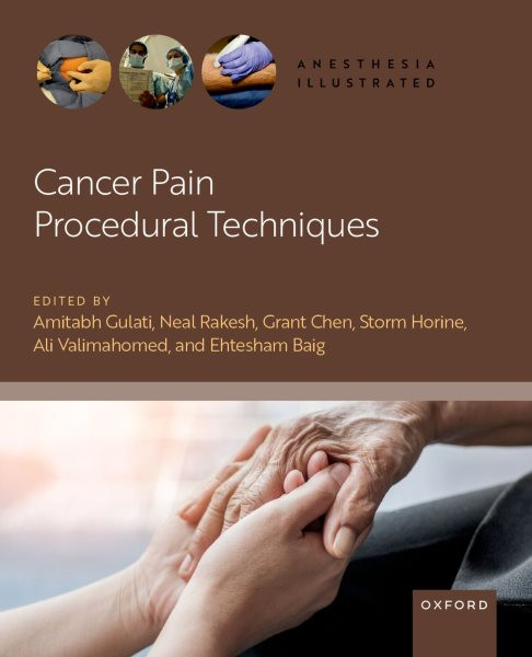 Cancer Pain Technique Book