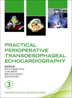 Practical Perioperative Transoesophageal Echocardiography 3rd Revised edition