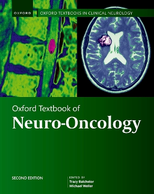 Oxford Textbook of Neuro-Oncology 2nd Revised edition