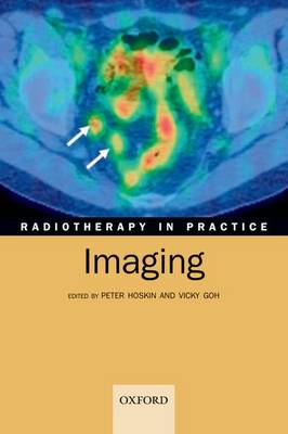 Radiotherapy in Practice - Imaging
