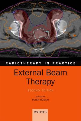 External Beam Therapy 2nd Revised edition