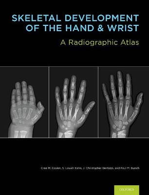 Skeletal Development of the Hand and Wrist: A Radiographic Atlas and Digital Bone Age Companion