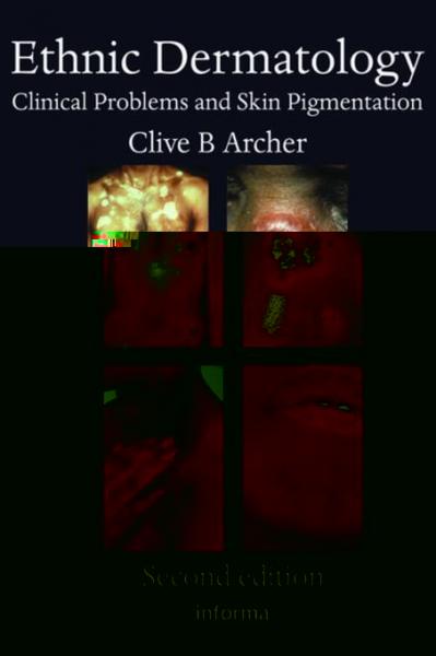 Ethnic Dermatology: Clinical Problems and Skin Pigmentation