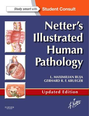 Netter's Illustrated Human Pathology Updated Edition E-book: Netter's Illustrated Human Pathology Updated Edition E-book