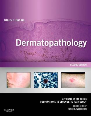 Dermatopathology E-Book: A Volume in the Series: Foundations in Diagnostic Pathology (Expert Consult - Online)