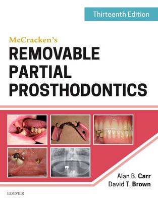McCracken's Removable Partial Prosthodontics 13th edition