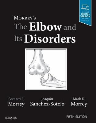 Morrey's The Elbow and Its Disorders E-Book