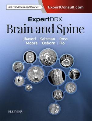 ExpertDDx: Brain and Spine 2nd edition