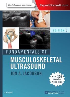 Fundamentals of Musculoskeletal Ultrasound E-Book: Fundamentals of Musculoskeletal Ultrasound E-Book