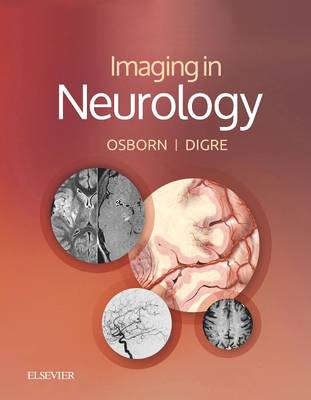 Imaging in Neurology E-Book: Imaging in Neurology E-Book