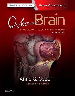 Osborn's Brain 2nd edition