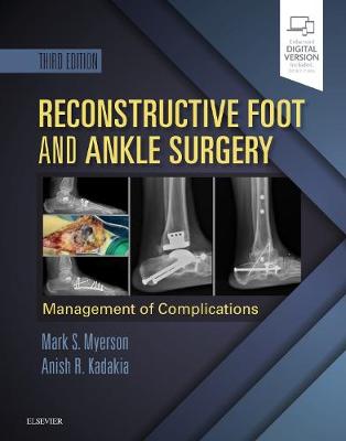 Reconstructive Foot and Ankle Surgery: Management of Complications E-Book