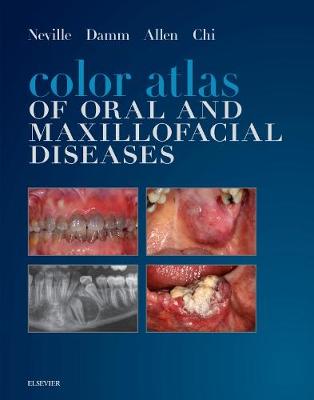 Color Atlas of Oral and Maxillofacial Diseases - E-Book: Color Atlas of Oral and Maxillofacial Diseases - E-Book