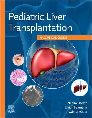 Pediatric Liver Transplantation: A Clinical Guide