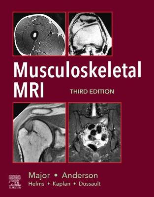 Musculoskeletal MRI E-Book