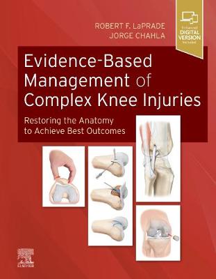 Evidence-Based Management of Complex Knee Injuries E-Book: Restoring the Anatomy to Achieve Best Outcomes