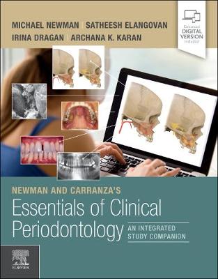 Newman and Carranza's Essentials of Clinical Periodontology E-Book: Newman and Carranza's Essentials of Clinical Periodontology E-Book