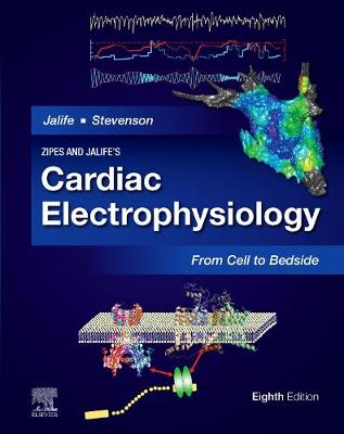 Zipes and Jalife's Cardiac Electrophysiology: From Cell to Bedside, E-Book