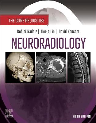Neuroradiology: The Requisites E-Book: The Core Requisites