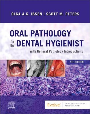 Oral Pathology for the Dental Hygienist 8th edition