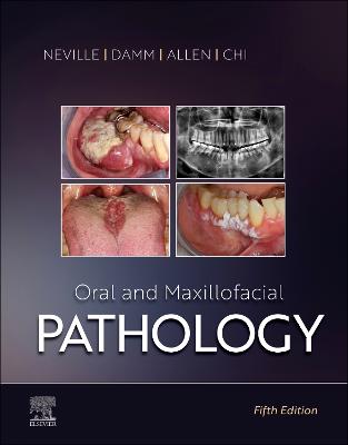 Oral and Maxillofacial Pathology - E-Book