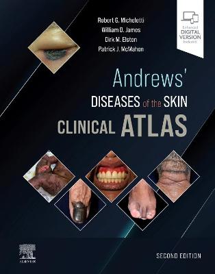 Andrews' Diseases of the Skin Clinical Atlas 2nd edition