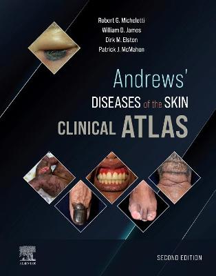 Andrews' Diseases of the Skin Clinical Atlas,E-Book: Andrews' Diseases of the Skin Clinical Atlas,E-Book