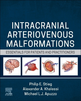 Intracranial Arteriovenous Malformations - E-Book: Essentials for Patients and Practitioners