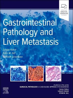 Gastrointestinal Pathology and Liver Metastasis: A Case-Based Approach to  Diagnosis