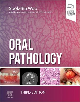 Oral Pathology 3rd edition
