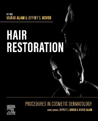 Procedures in Cosmetic Dermatology: Hair Restoration - E-Book