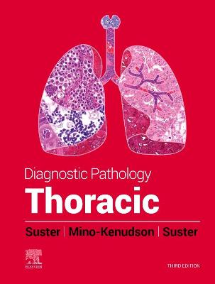 Diagnostic Pathology: Thoracic - E-Book: Diagnostic Pathology: Thoracic - E-Book