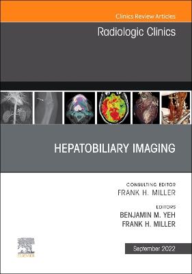 Hepatobiliary Imaging, An Issue of Radiologic Clinics of North America, E-Book: Hepatobiliary Imaging, An Issue of Radiologic Clinics of North America, E-Book