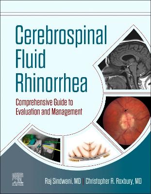 Cerebrospinal Fluid Rhinorrhea - E-Book: Comprehensive Guide to Evaluation and Management
