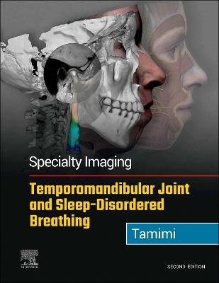 Specialty Imaging: Temporomandibular Joint and Sleep-Disordered Breathing E-Book: Specialty Imaging: Temporomandibular Joint and Sleep-Disordered Breathing E-Book