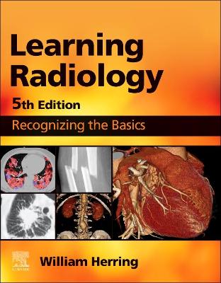 Learning Radiology E-Book: Learning Radiology E-Book