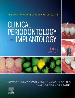 Newman and Carranza's Clinical Periodontology and Implantology E-Book: Newman and Carranza's Clinical Periodontology and Implantology E-Book