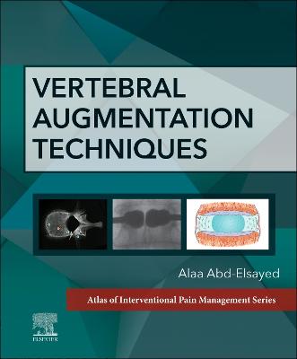Vertebral Augmentation Techniques - E-Book